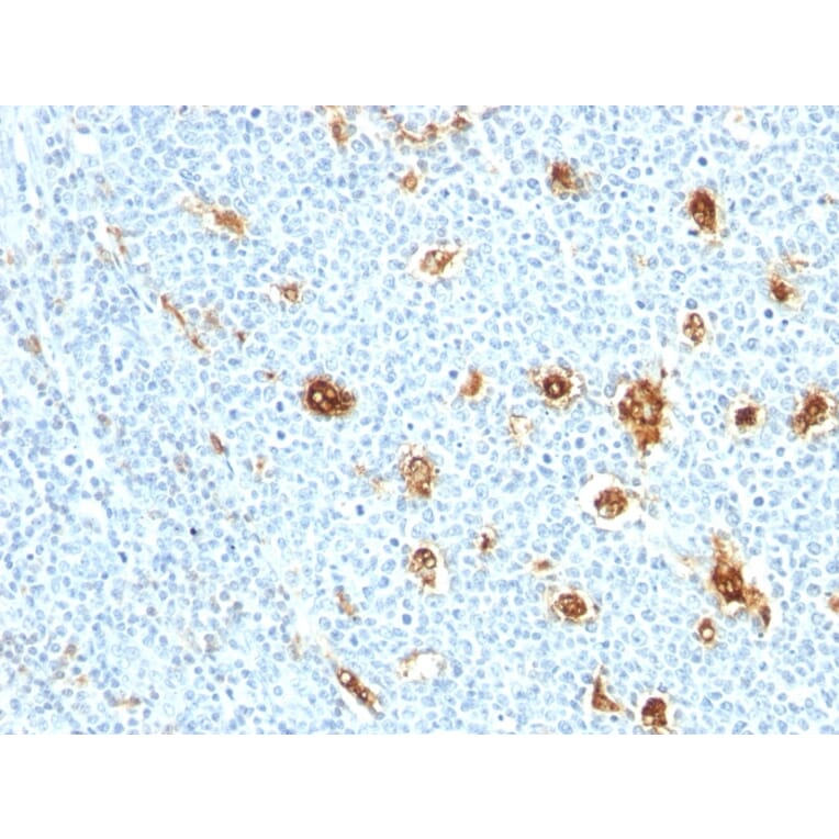 Immunohistochemistry - Anti-Calprotectin Antibody [MRP14/840] - BSA and Azide free (A253108) - Antibodies.com