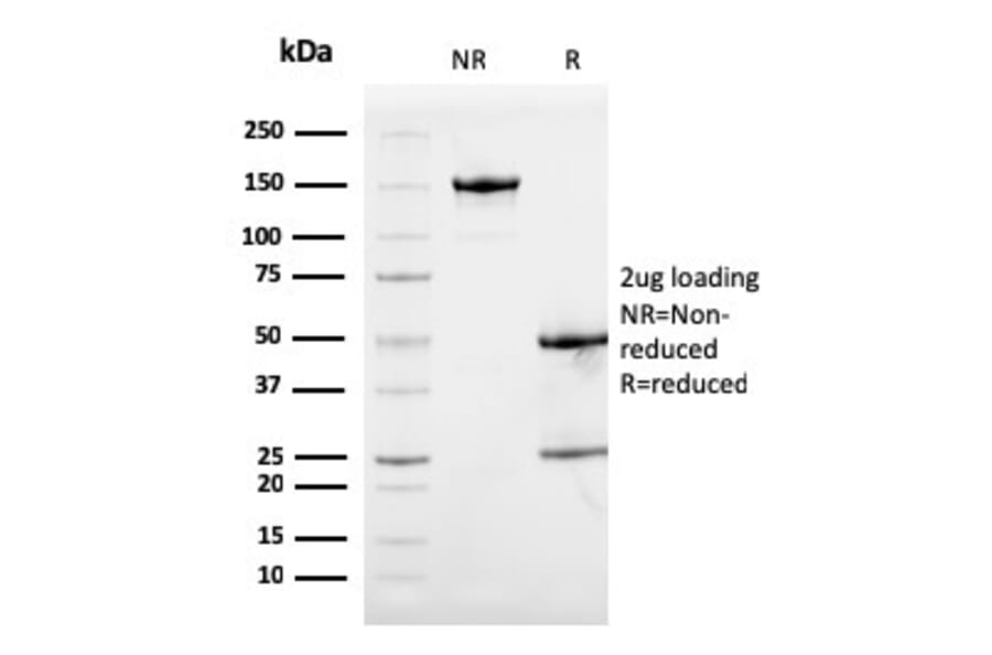 SDS-PAGE - Anti-Calprotectin Antibody [S100A9/1075] - BSA and Azide free (A253110) - Antibodies.com