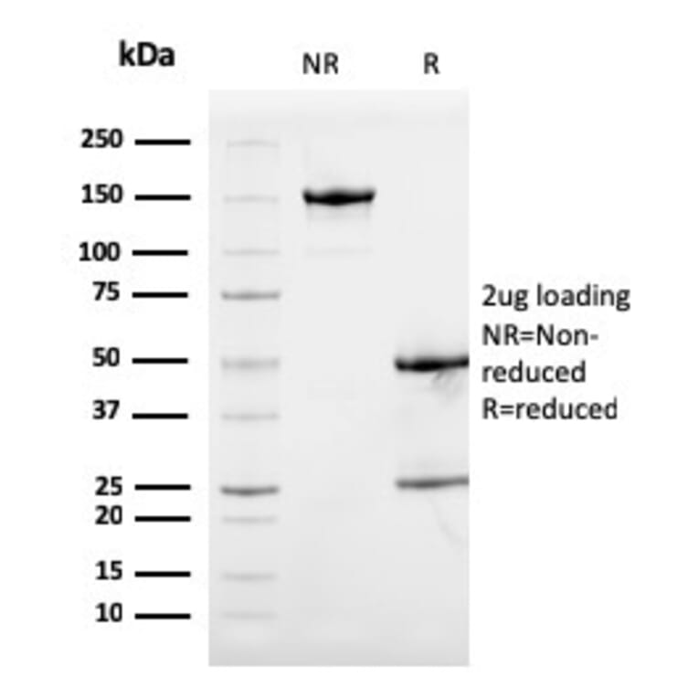 SDS-PAGE - Anti-Calprotectin Antibody [S100A9/1075] - BSA and Azide free (A253110) - Antibodies.com