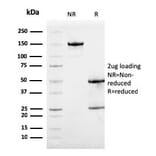 SDS-PAGE - Anti-Calprotectin Antibody [S100A9/1075] - BSA and Azide free (A253110) - Antibodies.com