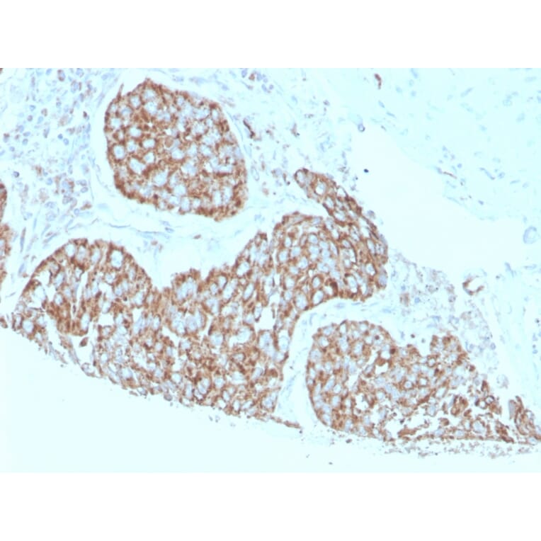 Immunohistochemistry - Anti-Calprotectin Antibody [S100A9/1075] - BSA and Azide free (A253109) - Antibodies.com