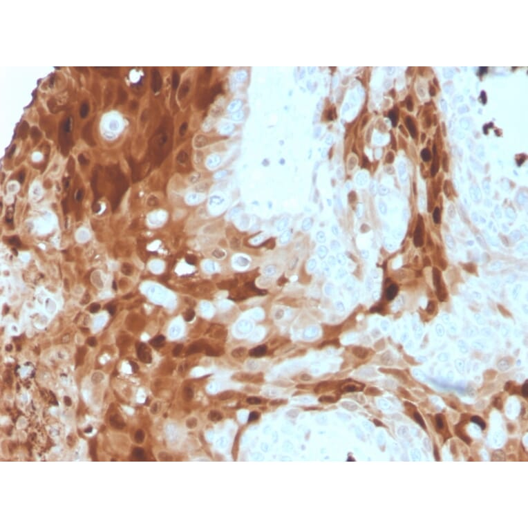 Immunohistochemistry - Anti-Calprotectin Antibody [S100A9/1075] - BSA and Azide free (A253110) - Antibodies.com