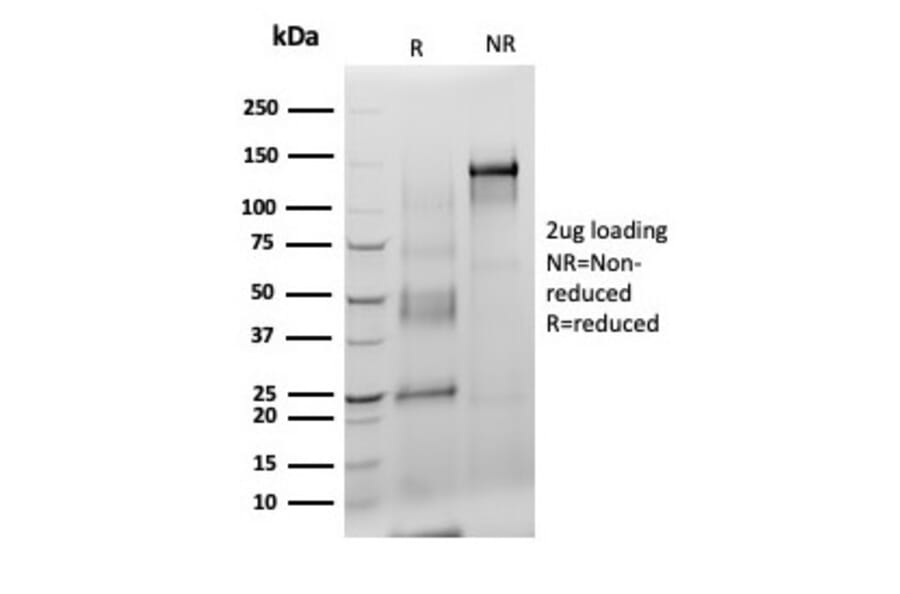 SDS-PAGE - Anti-S100 beta Antibody [S100B/4140] - BSA and Azide free (A253112) - Antibodies.com