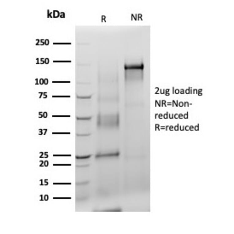 SDS-PAGE - Anti-S100 beta Antibody [S100B/4140] - BSA and Azide free (A253112) - Antibodies.com