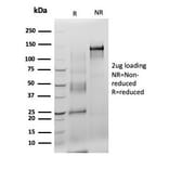 SDS-PAGE - Anti-S100 beta Antibody [S100B/4140] - BSA and Azide free (A253112) - Antibodies.com