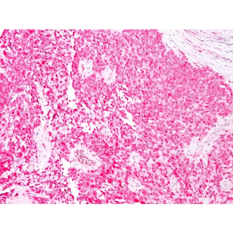 Immunohistochemistry - Anti-S100 beta Antibody [4C4.9] - BSA and Azide free (A253114) - Antibodies.com