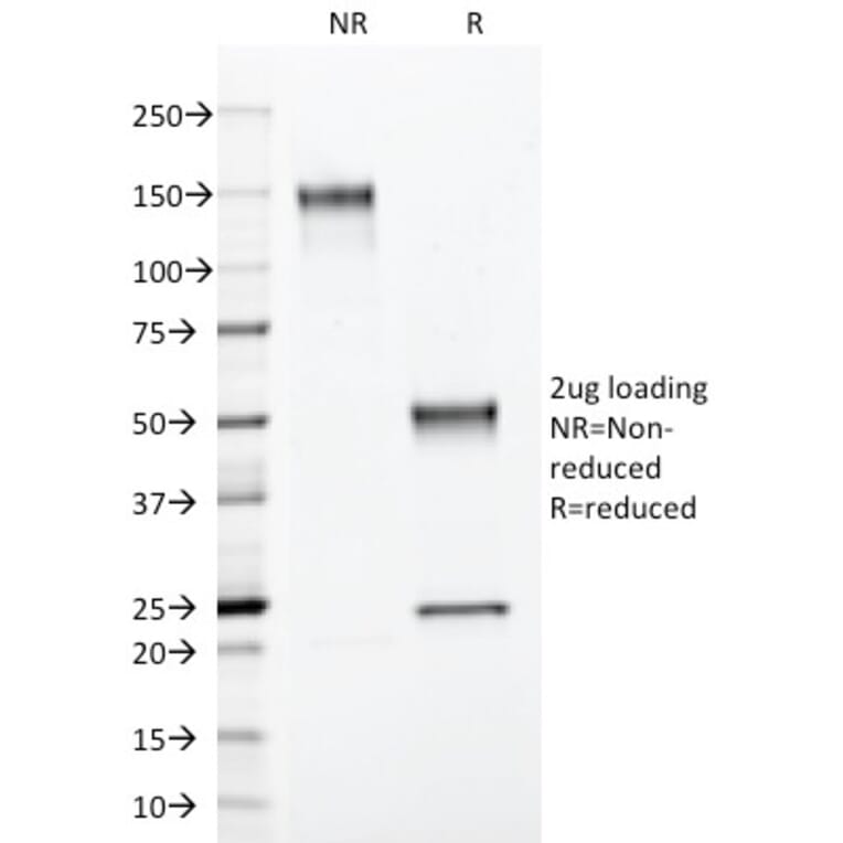 SDS-PAGE - Anti-S100 beta Antibody [4C4.9] - BSA and Azide free (A253114) - Antibodies.com
