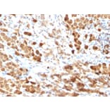 Immunohistochemistry - Anti-S100 beta Antibody [SPM354] - BSA and Azide free (A253114) - Antibodies.com