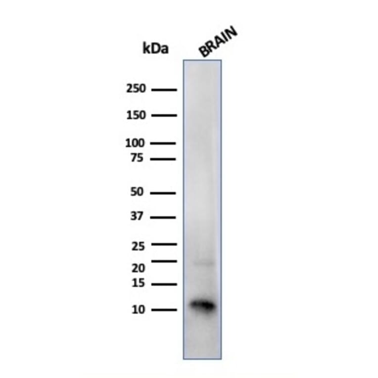 Western Blot - Anti-S100 beta Antibody [SPM354] - BSA and Azide free (A253115) - Antibodies.com