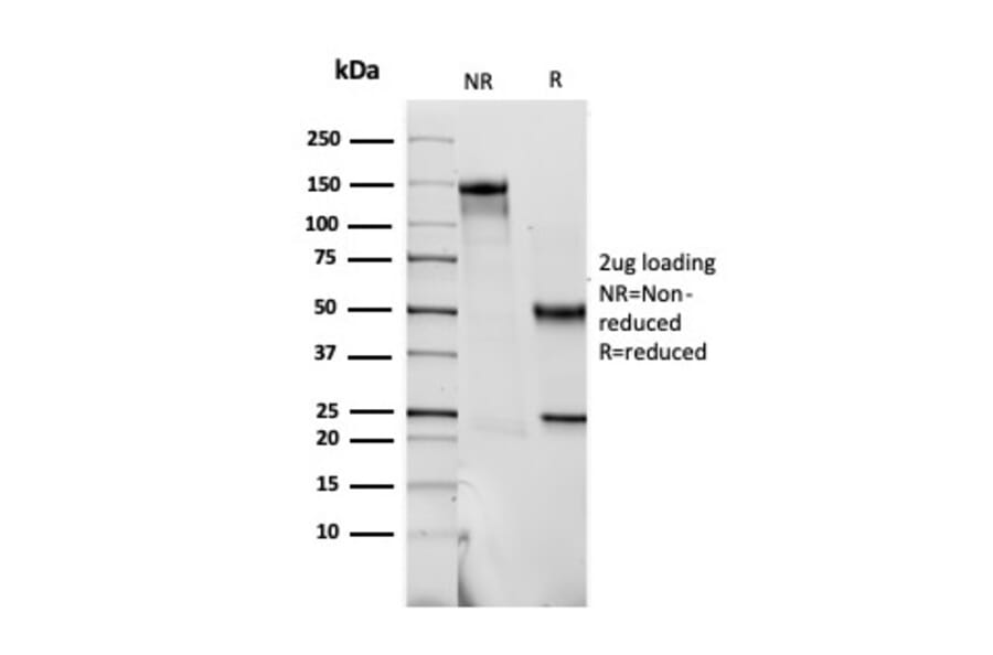 SDS-PAGE - Anti-S100 beta Antibody [SPM354] - BSA and Azide free (A253115) - Antibodies.com
