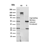 SDS-PAGE - Anti-S100 beta Antibody [SPM354] - BSA and Azide free (A253115) - Antibodies.com