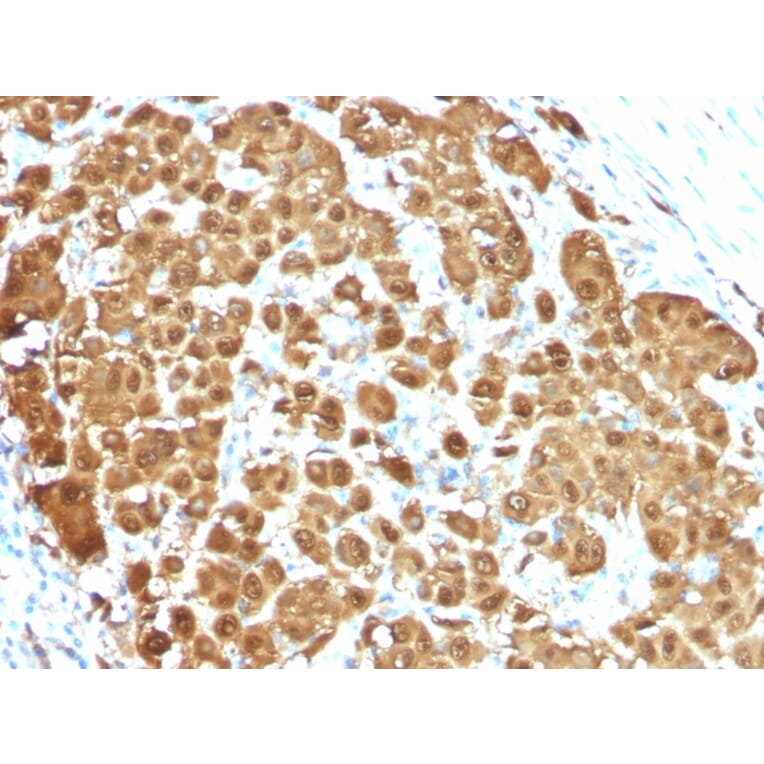 Immunohistochemistry - Anti-S100 beta Antibody [S100B/1012] - BSA and Azide free (A253116) - Antibodies.com
