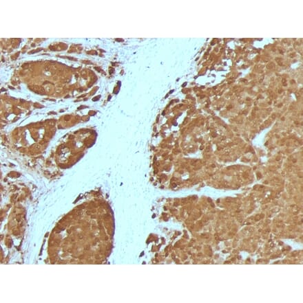 Immunohistochemistry - Anti-S100 beta Antibody [4C4.9 + S100B/1012] - BSA and Azide free (A253117) - Antibodies.com