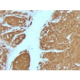 Immunohistochemistry - Anti-S100 beta Antibody [4C4.9 + S100B/1012] - BSA and Azide free (A253117) - Antibodies.com