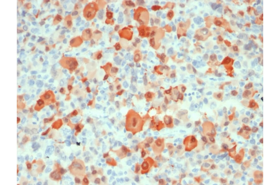 Immunohistochemistry - Anti-S100 beta Antibody [rS100B/1896] - BSA and Azide free (A253118) - Antibodies.com