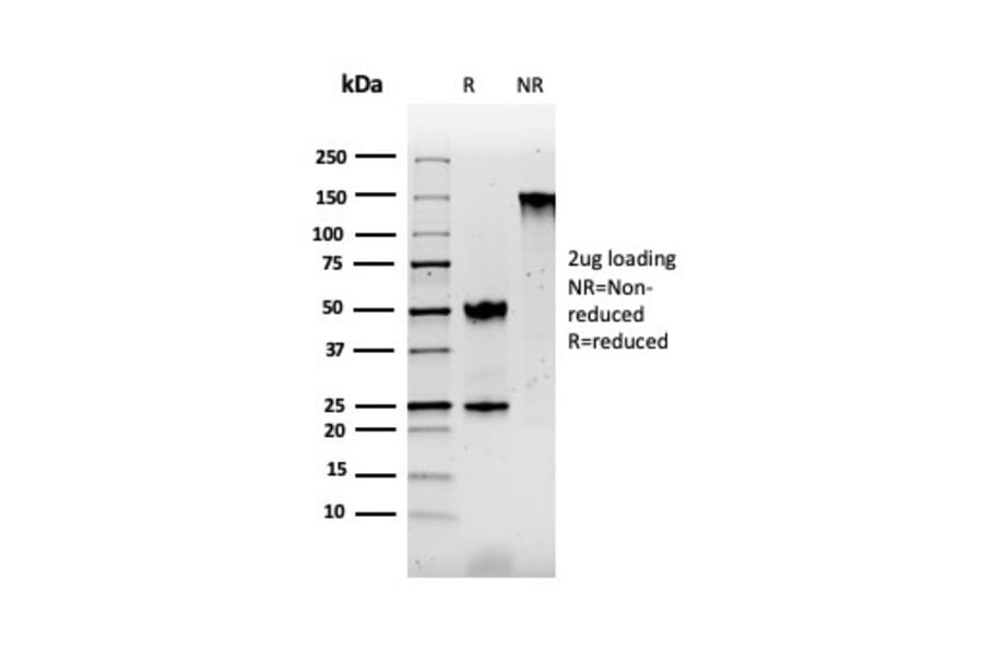 SDS-PAGE - Anti-S100 beta Antibody [rS100B/1896] - BSA and Azide free (A253118) - Antibodies.com