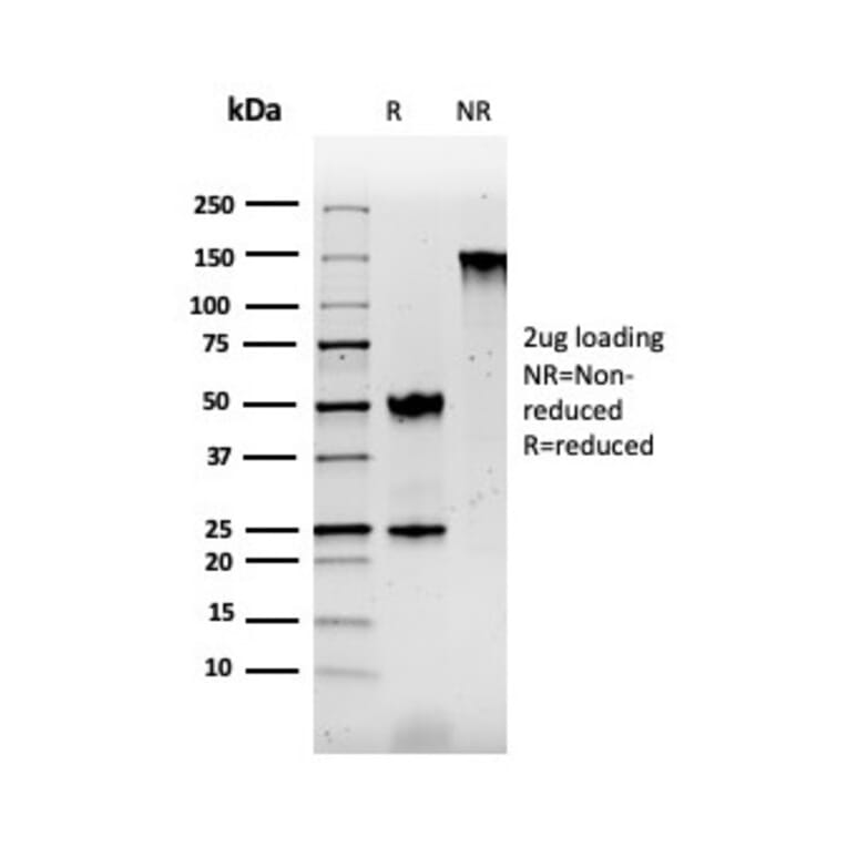 SDS-PAGE - Anti-S100 beta Antibody [rS100B/1896] - BSA and Azide free (A253118) - Antibodies.com
