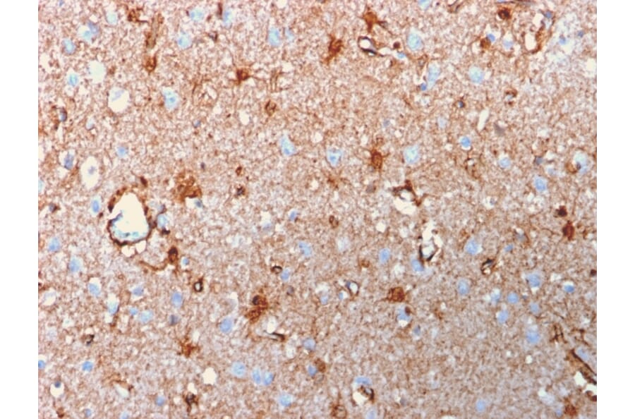 Immunohistochemistry - Anti-S100 beta Antibody [rS100B/1896] - BSA and Azide free (A253118) - Antibodies.com