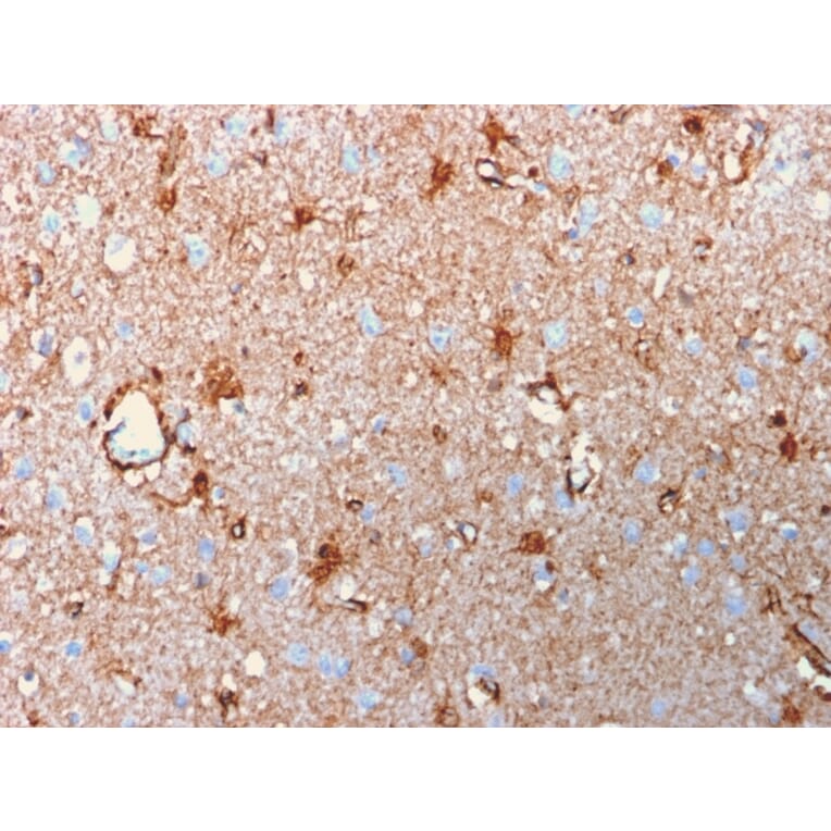 Immunohistochemistry - Anti-S100 beta Antibody [rS100B/1896] - BSA and Azide free (A253118) - Antibodies.com