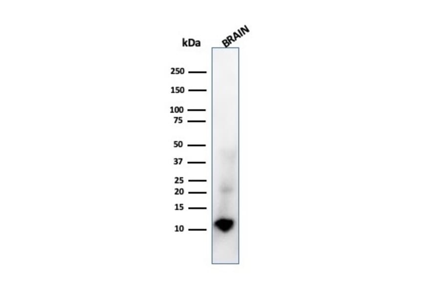 Western Blot - Anti-S100 beta Antibody [rS100B/1896] - BSA and Azide free (A253118) - Antibodies.com