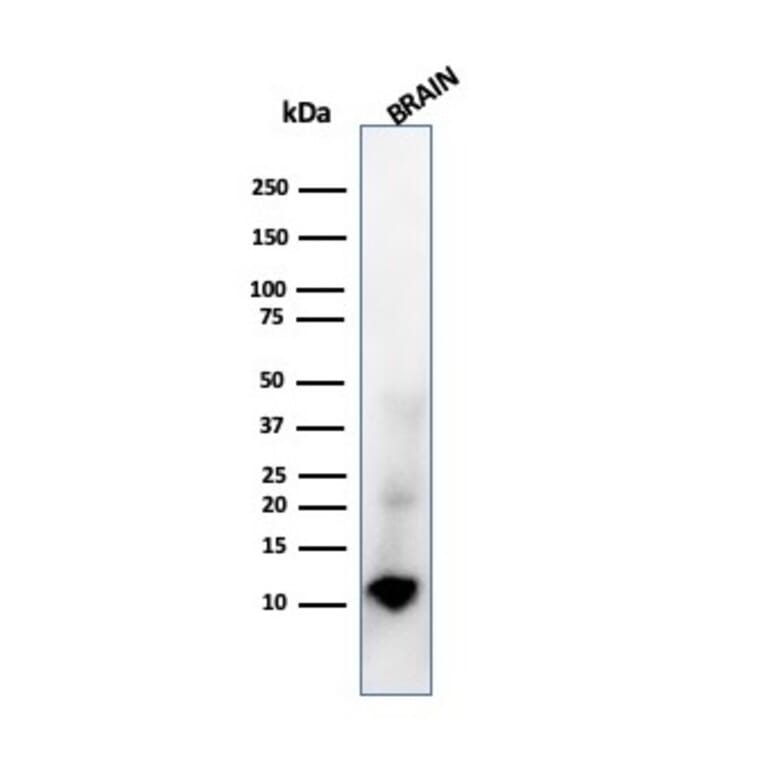 Western Blot - Anti-S100 beta Antibody [rS100B/1896] - BSA and Azide free (A253118) - Antibodies.com