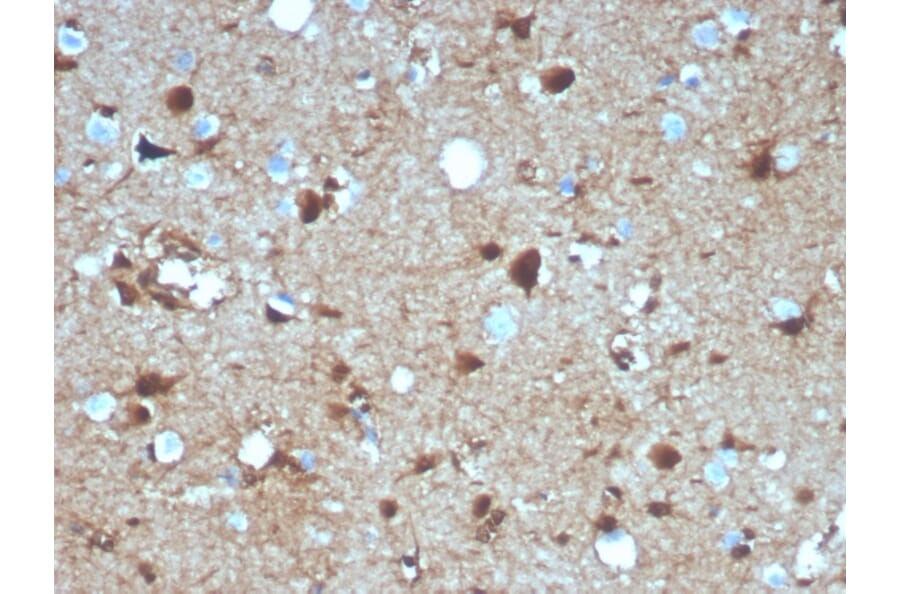 Immunohistochemistry - Anti-S100 beta Antibody [S100B/4139] - BSA and Azide free (A253119) - Antibodies.com
