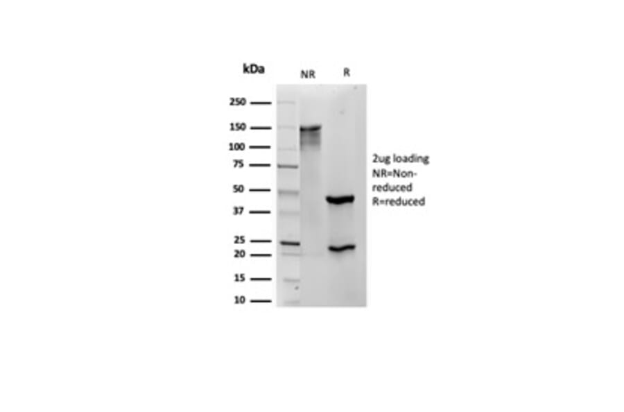 SDS-PAGE - Anti-S100 beta Antibody [S100B/4139] - BSA and Azide free (A253119) - Antibodies.com