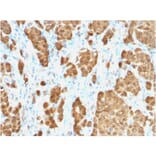 Immunohistochemistry - Anti-S100 beta Antibody [S100B/1706R] - BSA and Azide free (A253120) - Antibodies.com
