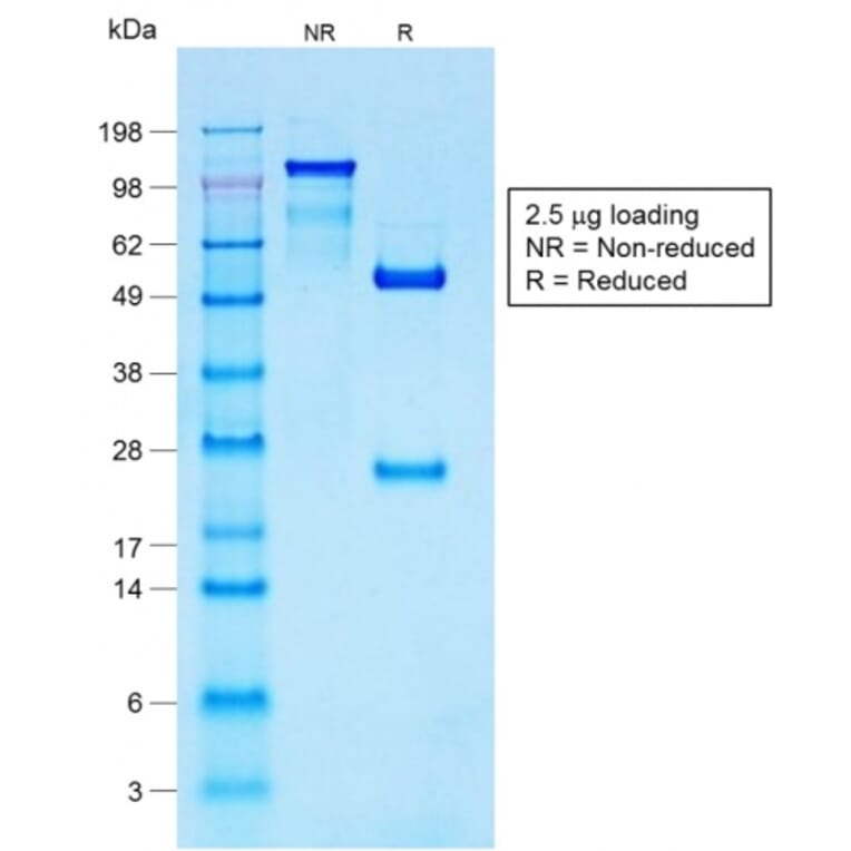 SDS-PAGE - Anti-S100 beta Antibody [S100B/1706R] - BSA and Azide free (A253120) - Antibodies.com