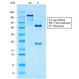 SDS-PAGE - Anti-S100 beta Antibody [S100B/1706R] - BSA and Azide free (A253120) - Antibodies.com