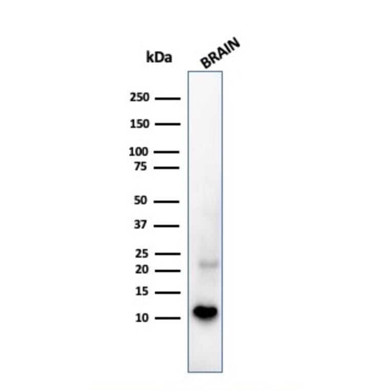 Western Blot - Anti-S100 beta Antibody [S100B/1706R] - BSA and Azide free (A253120) - Antibodies.com