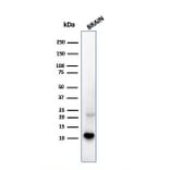 Western Blot - Anti-S100 beta Antibody [S100B/1706R] - BSA and Azide free (A253120) - Antibodies.com