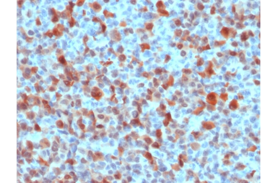 Immunohistochemistry - Anti-S100 beta Antibody - BSA and Azide free (A253120) - Antibodies.com
