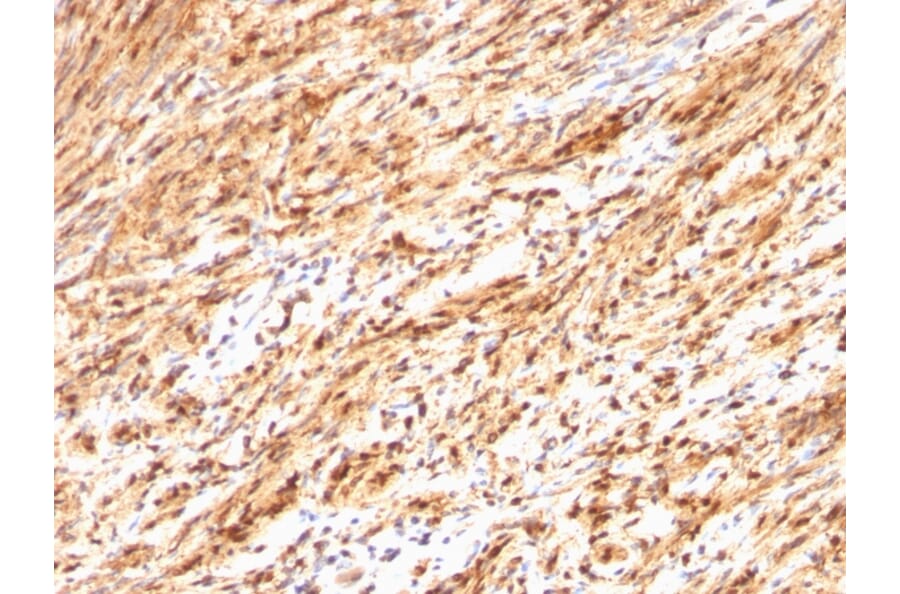 Immunohistochemistry - Anti-S100 beta Antibody - BSA and Azide free (A253121) - Antibodies.com
