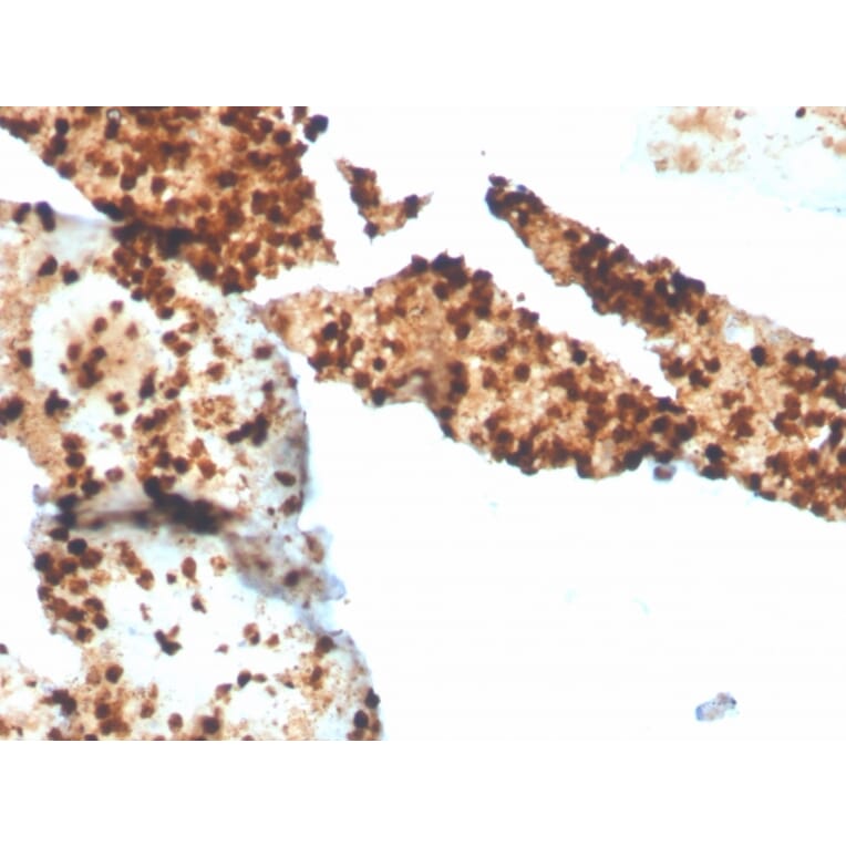 Immunohistochemistry - Anti-S100P Antibody [S100P/4386R] - BSA and Azide free (A253121) - Antibodies.com