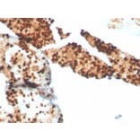 Immunohistochemistry - Anti-S100P Antibody [S100P/4386R] - BSA and Azide free (A253121) - Antibodies.com