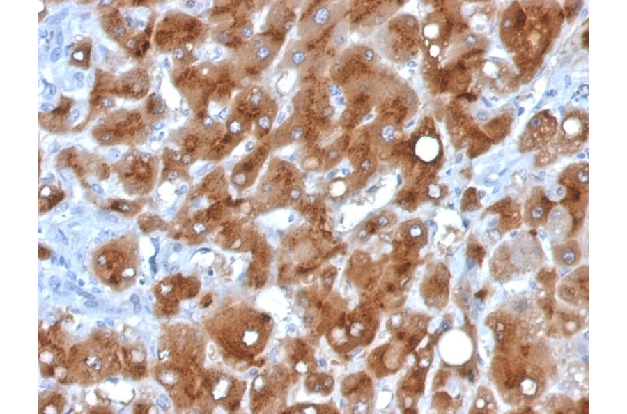 Immunohistochemistry - Anti-Serum Amyloid A Antibody [SAA/326] - BSA and Azide free (A253123) - Antibodies.com