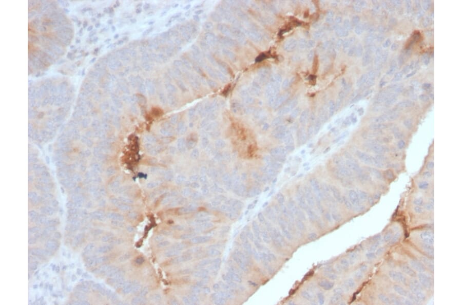 Immunohistochemistry - Anti-Serum Amyloid A Antibody [SAA/2868R] - BSA and Azide free (A253123) - Antibodies.com