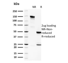 SDS-PAGE - Anti-Spermidine Antibody [CPTC-SAT1-3] - BSA and Azide free (A253125) - Antibodies.com