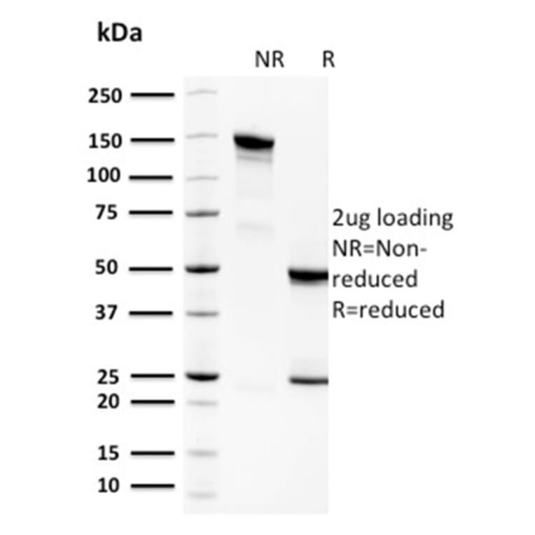 SDS-PAGE - Anti-Spermidine Antibody [CPTC-SAT1-3] - BSA and Azide free (A253125) - Antibodies.com