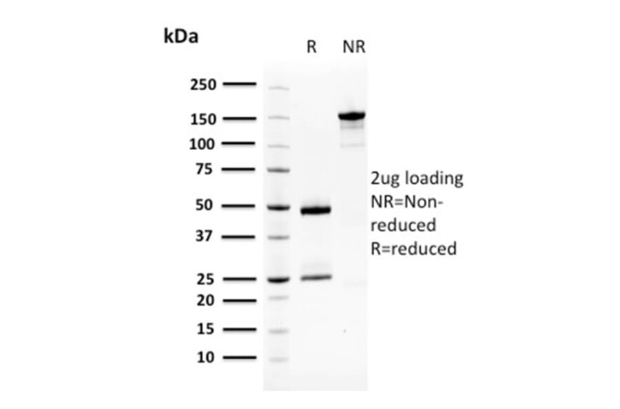 SDS-PAGE - Anti-Squamous Cell Carcinoma Antigen 1 Antibody [CPTC-SERPINB3-2] - BSA and Azide free (A253126) - Antibodies.com
