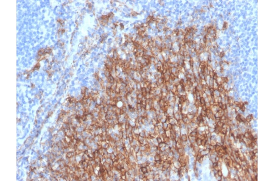 Immunohistochemistry - Anti-Syndecan 1 Antibody [SDC1/4378R] - BSA and Azide free (A253127) - Antibodies.com