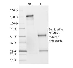 SDS-PAGE - Anti-SDHB Antibody [SDHB/2382] - BSA and Azide free (A253128) - Antibodies.com