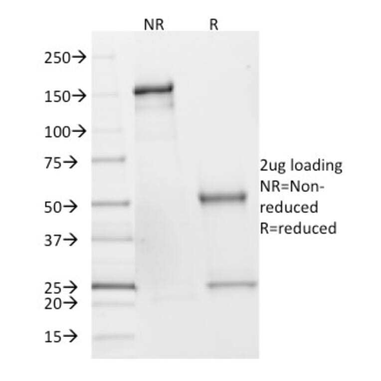 SDS-PAGE - Anti-SDHB Antibody [SDHB/2382] - BSA and Azide free (A253128) - Antibodies.com