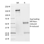 SDS-PAGE - Anti-SDHB Antibody [SDHB/2382] - BSA and Azide free (A253128) - Antibodies.com