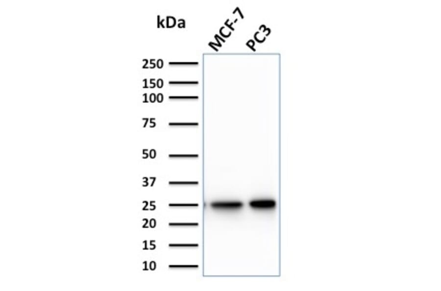 Western Blot - Anti-CHP2 Antibody [CPTC-CHP2-1] - BSA and Azide free (A253129) - Antibodies.com