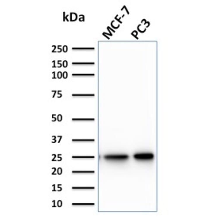 Western Blot - Anti-CHP2 Antibody [CPTC-CHP2-1] - BSA and Azide free (A253129) - Antibodies.com