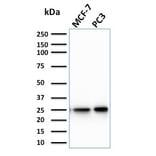 Western Blot - Anti-CHP2 Antibody [CPTC-CHP2-1] - BSA and Azide free (A253129) - Antibodies.com