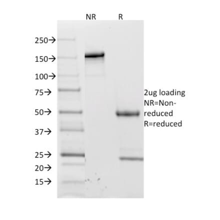 SDS-PAGE - Anti-CD62L Antibody [CD62L/1588] - BSA and Azide free (A253129) - Antibodies.com