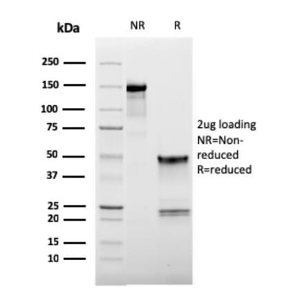 SDS-PAGE - Anti-CD62L Antibody [LAM1-116] - BSA and Azide free (A253130) - Antibodies.com